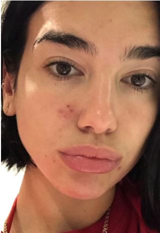 Dua Lipa without Makeup