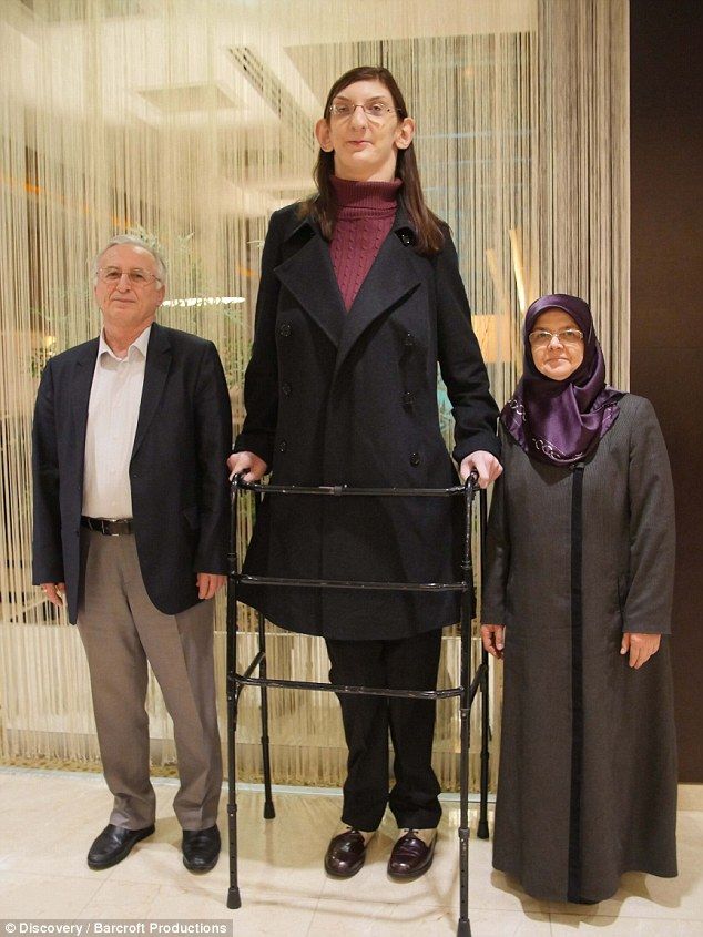 Tallest woman in the world: Rumeysa Gelgi